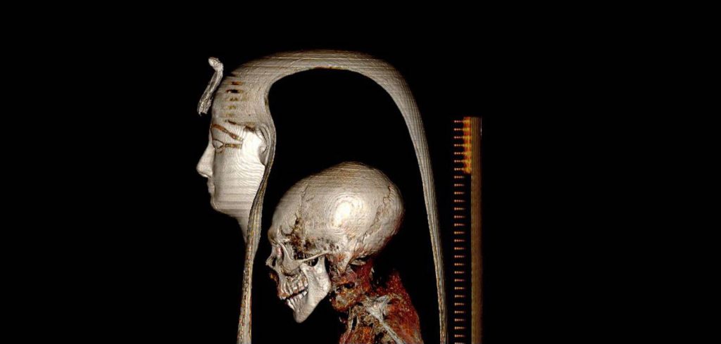 bilgisayarlı tomografi taraması kullanarak oluşturulan Kral Amenhotep'in başı