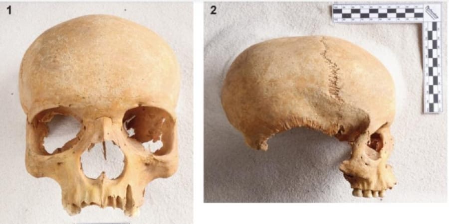 Bohemya'da ortaçağ mezarlığında siyah kadının kafatası bulundu